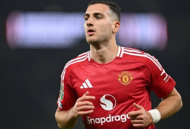 Ngôi sao MU chỉ trích lối chơi của Quỷ Đỏ