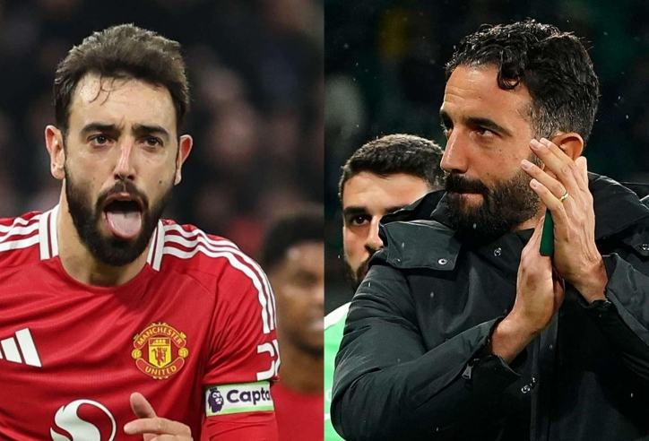 HLV Ruben Amorim: 'Hôm nay MU đá hay hơn nhưng vẫn thua'