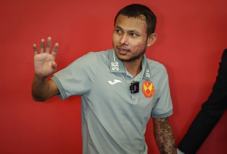 Cầu thủ Malaysia bị tạt axit tái xuất
