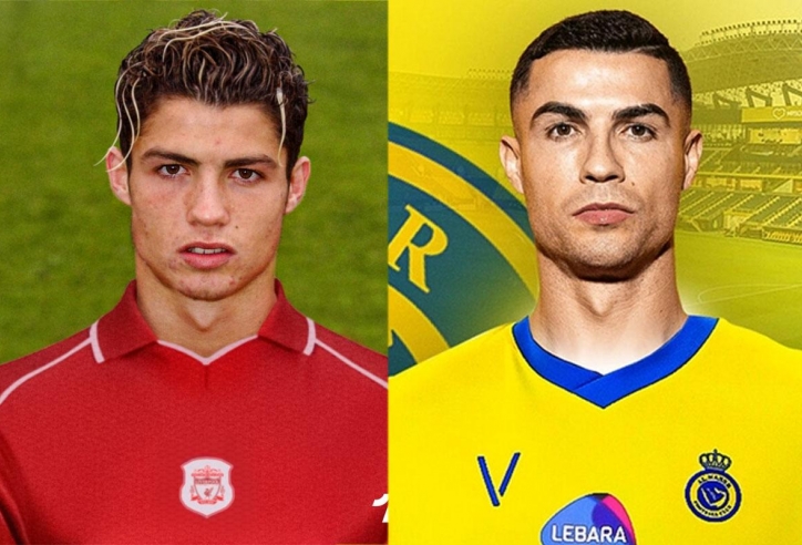 Ronaldo can thiệp 'dao kéo' để có ngoại hình đẹp ở tuổi 40