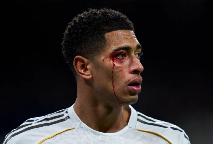 Jude Bellingham rách mắt, vẫn bị trọng tài phạt thẻ vàng