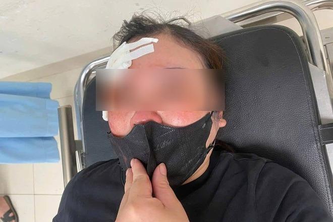 Khi mâu thuẫn giao thông thành ẩu đả: Một phút thiếu kiềm chế, hậu quả khôn lường