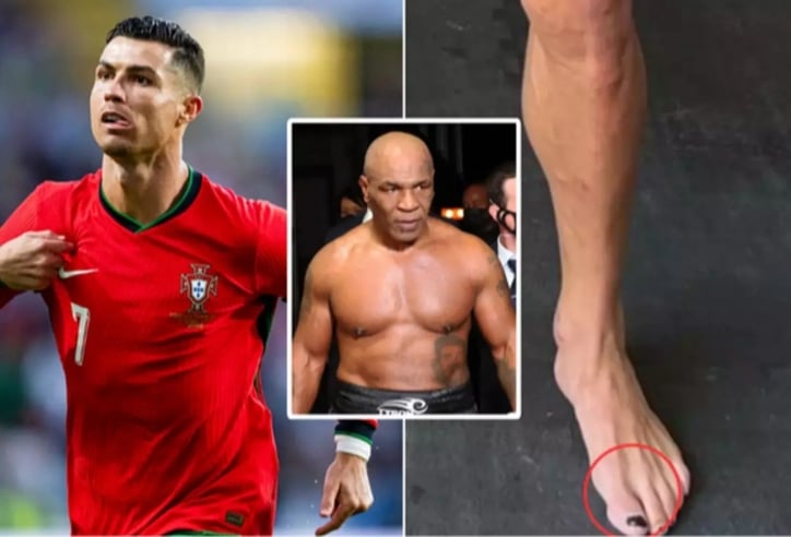 Ngã ngửa với lý do Ronaldo sử dụng 'sơn móng chân'
