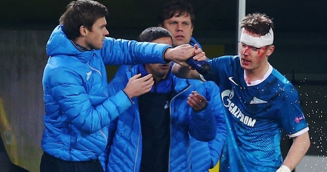 Lewandowski khiến hậu vệ Zenit gặp chấn thương kinh hoàng
