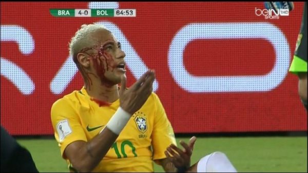 VIDEO: Pha va chạm khiến Neymar 'máu chảy bê bết'