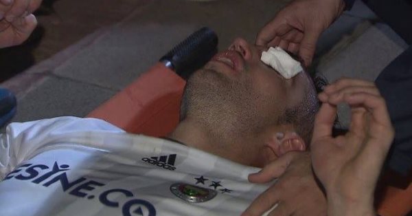 VIDEO: Pha va chạm khiến Van Persie suýt mù 1 mắt