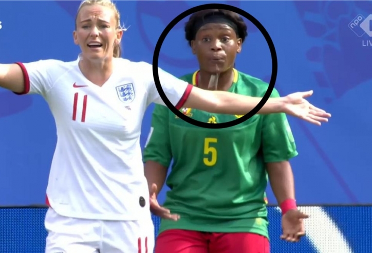 Cầu thủ Cameroon nhổ nước bọt vào cầu thủ Anh tại World Cup