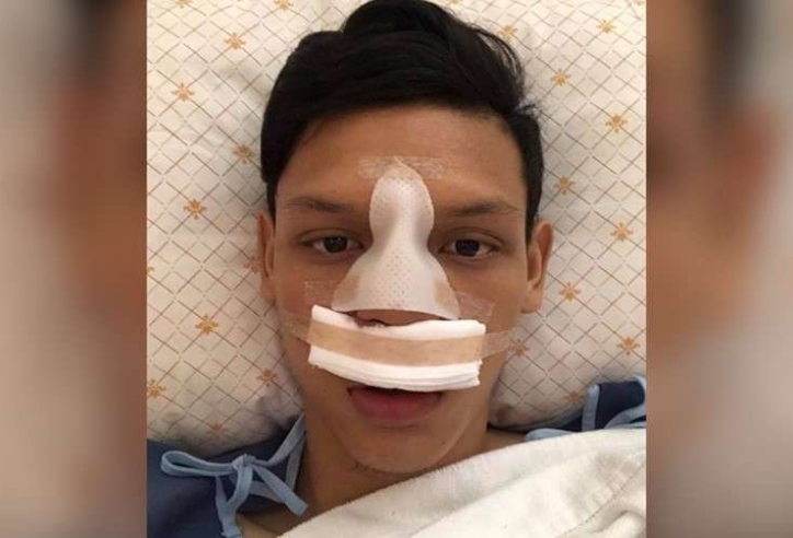 Buiram forward Supachai broke his nose in a violent phase against Chiangmai