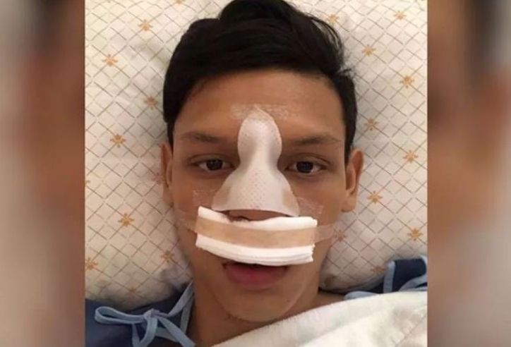 Cầu thủ Thái Lan từng đánh nguội Đình Trọng bị gãy mũi sau va chạm