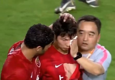 VIDEO: Cầu thủ Trung Quốc gây phản cảm với cú đá bạo lực vào mặt đồng nghiệp