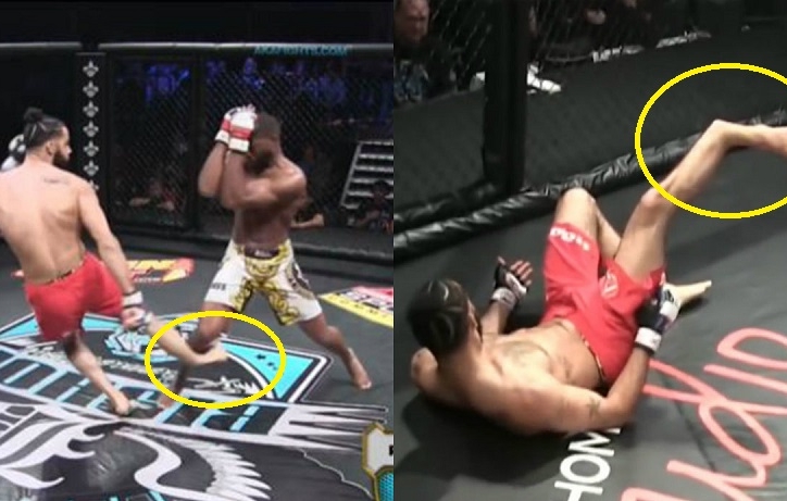 VIDEO: Võ sĩ MMA bị gãy chân ghê rợn khi tung cú đá vào đối thủ