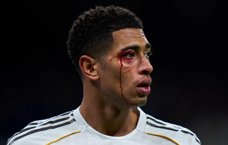 Jude Bellingham rách mắt, vẫn bị trọng tài phạt thẻ vàng