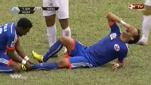 Video bóng đá: Cận cảnh chấn thương 'rùng rợn' của cầu thủ Than Quảng Ninh