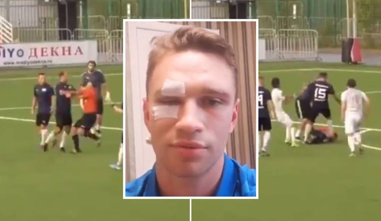 VIDEO: Cựu đội trưởng tuyển Nga đánh trọng tài nhập viện