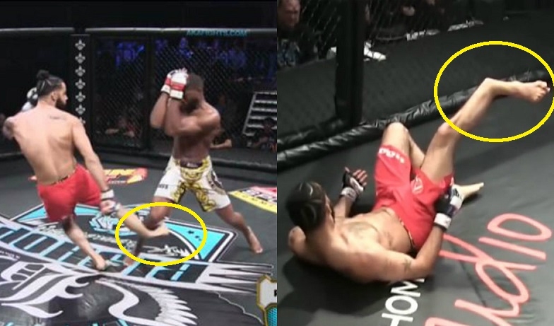 VIDEO: Võ sĩ MMA bị gãy chân ghê rợn khi tung cú đá vào đối thủ