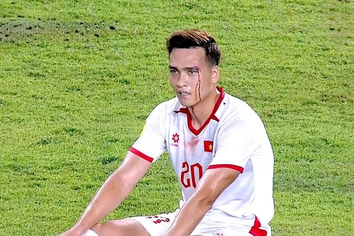 Trung vệ số 1 ĐT Việt Nam phải nhập viện sau trận thắng Indonesia