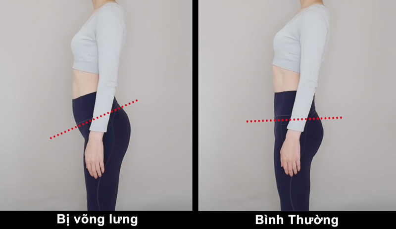 Tập plank bị đau cơ bụng