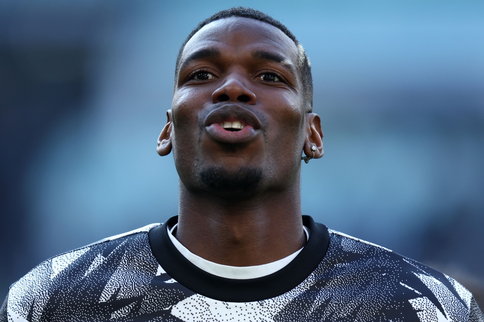 Pogba vô kỷ luật khi dưỡng thương, huyền thoại Italia lên tiếng 248450