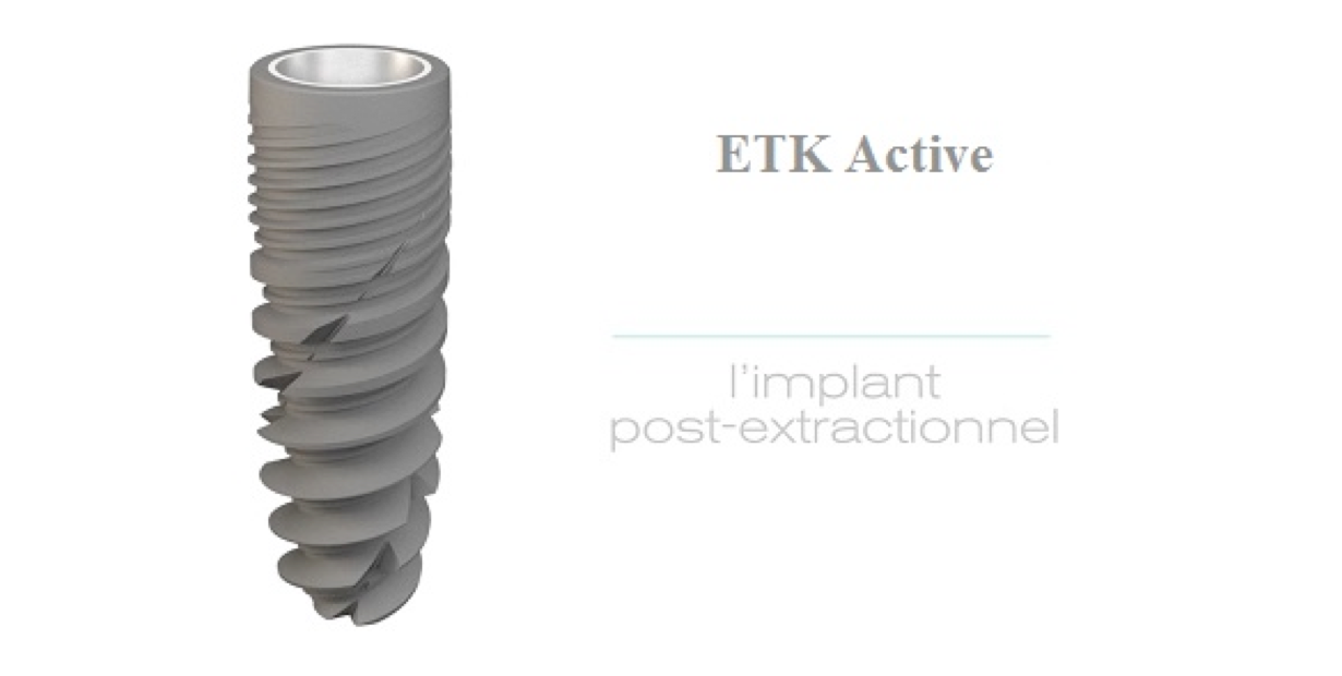 trong rang Implant ETK Active