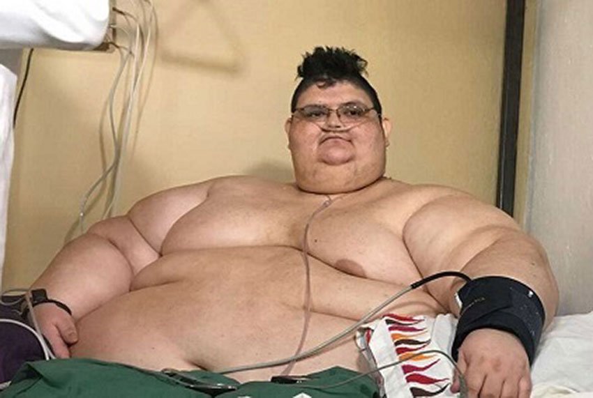 Top 10 người béo nhất thế giới đến từ đâu?